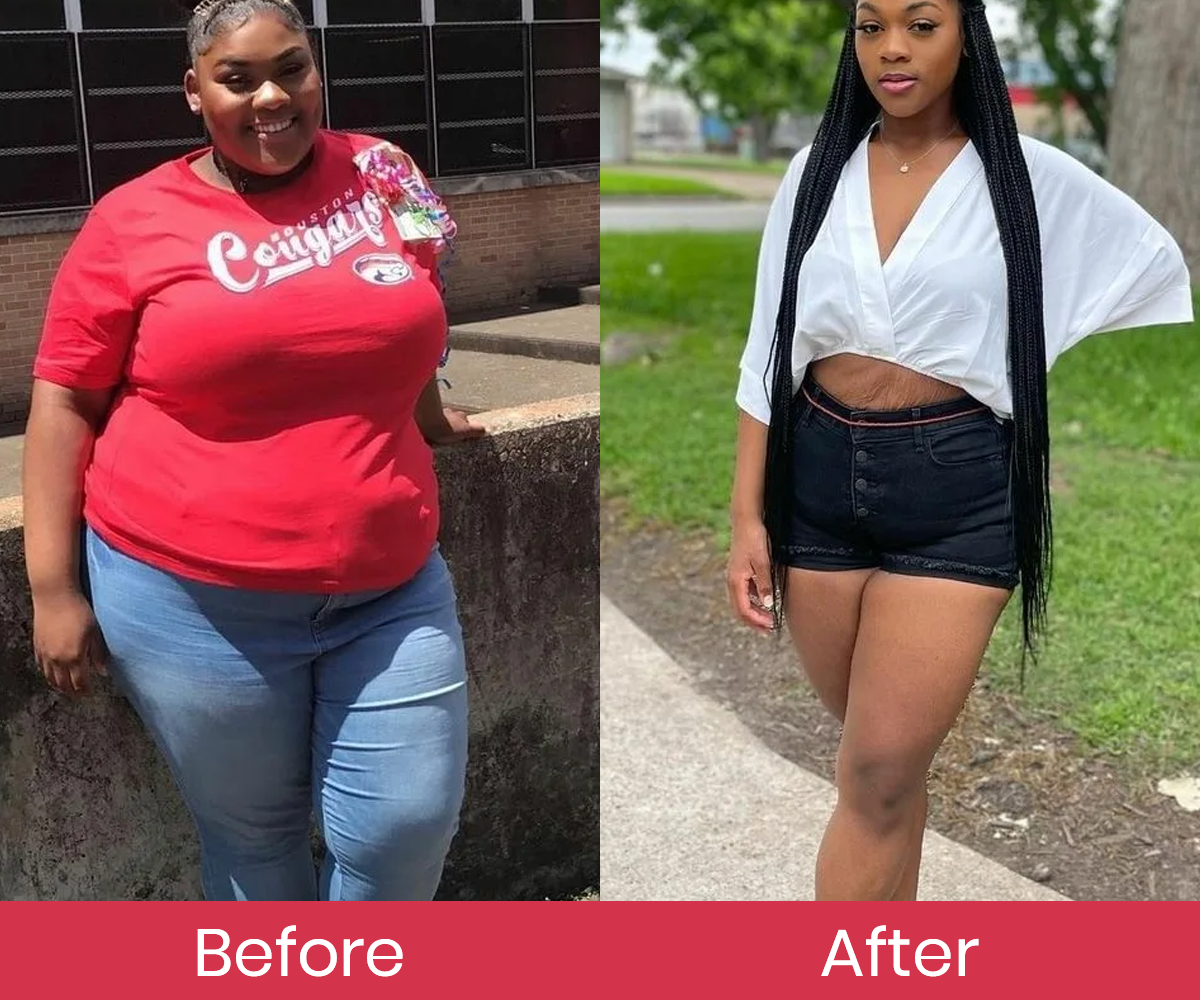 Luhaka™ TrimSilk Sculpting & Cellulite Reduction Massage Gel 19 1 16d5975a 90cb 4385 9503 4734759fbee1