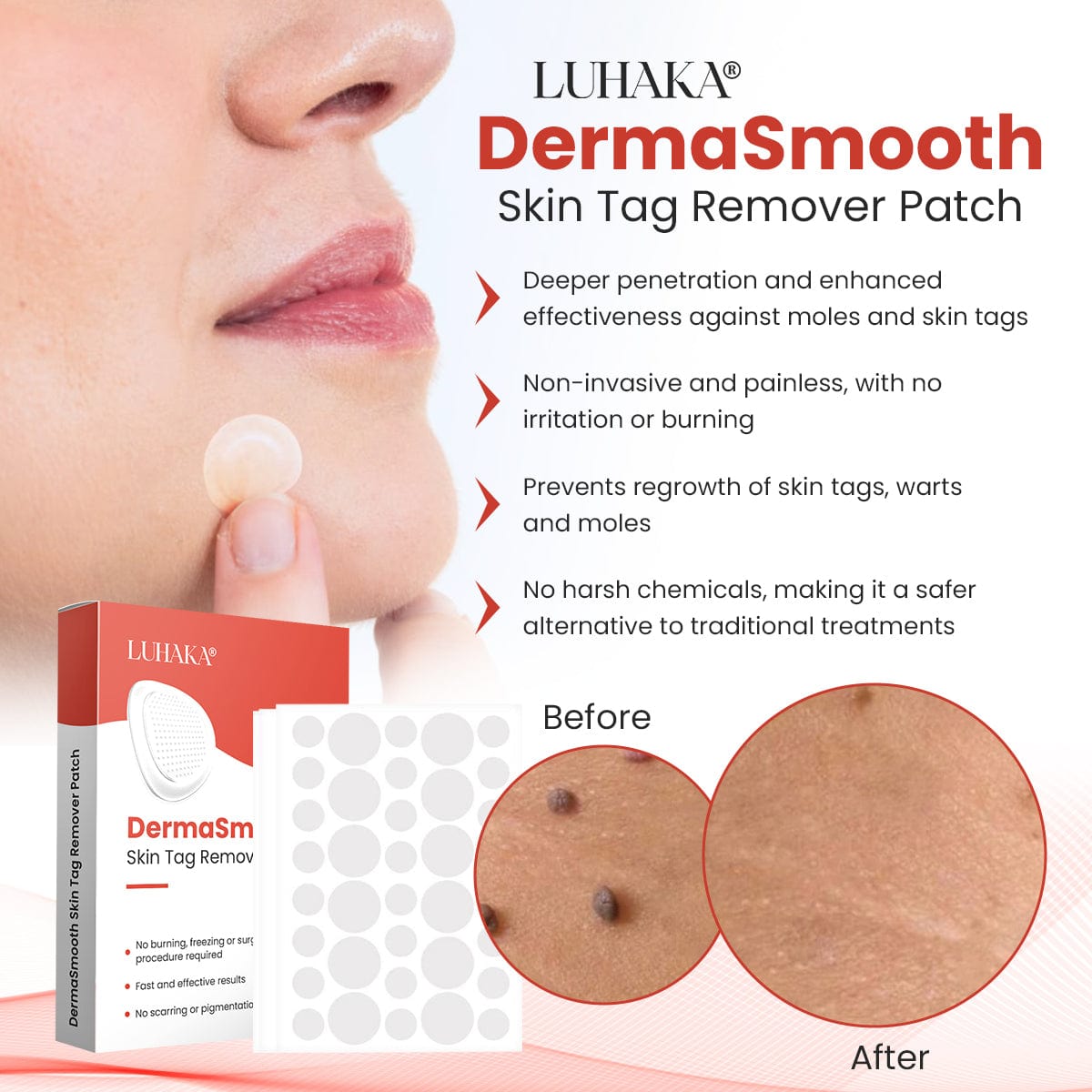 Luhaka® DermaSmooth Skin Tag Remover Patch 2