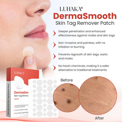 Luhaka® DermaSmooth Skin Tag Remover Patch 2